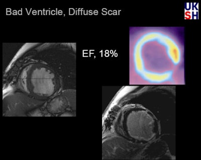 2009 01 02 15 20 49 150 Hunold patient18