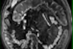 2009 01 15 16 54 02 644 Achiam thumb 01 09