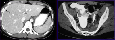 2009 01 20 15 53 51 486 Lemos casetwo
