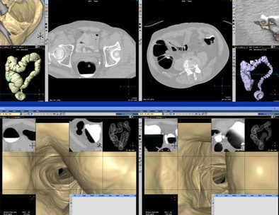 2009 02 04 11 55 05 140 Devries primary2d3dcases