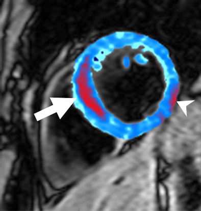 2009 02 12 14 58 46 554 Bleeding Heart Arrows Resized
