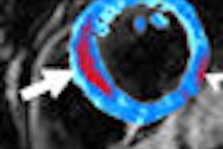 2009 02 12 14 58 51 677 Bleeding Heart Arrows Thumb