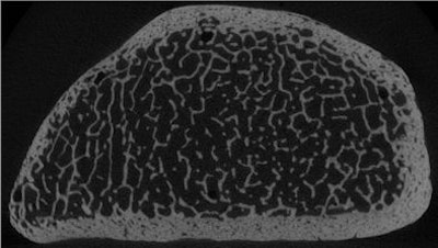 2009 04 01 13 22 56 997 Issever trabecularbone 394