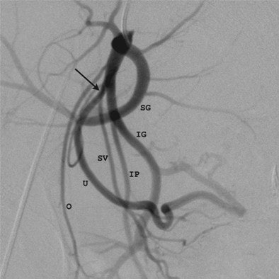 2009 05 27 14 15 03 206 Figure1 B Naguib 394 2