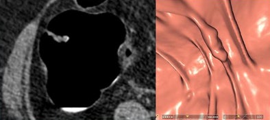 2009 06 01 14 10 29 293 Iafrate 6haustral doc