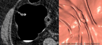 2009 06 01 14 10 29 293 Iafrate 6haustral doc