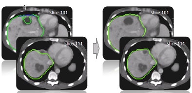 2009 06 30 13 23 16 756 Heckel algorithm results