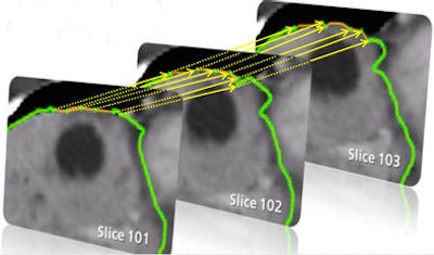 2009 06 30 13 34 52 9 Heckel algorithm1bottom V2