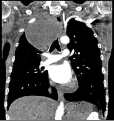 2009 07 06 13 05 14 290 Remyjardin ru Lmass