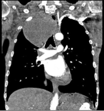 2009 07 06 13 05 14 290 Remyjardin ru Lmass