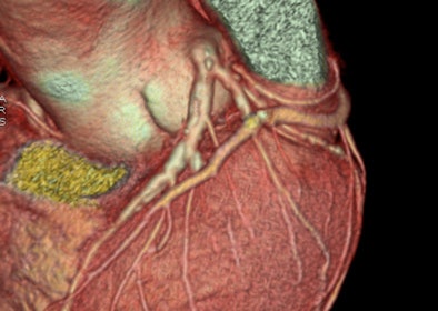 2009 07 17 10 17 30 103 Pontone 70yomale highdose 394