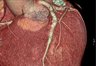 2009 07 17 10 17 31 330 Pontone 74yom 394