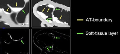 2009 07 28 11 21 17 447 Yoshida localroughness bottom