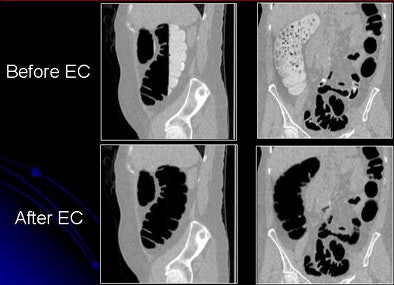 2009 07 28 11 21 22 591 Yoshida beforeafter 2 D top