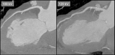 2009 08 10 11 38 56 701 Bild1 V2