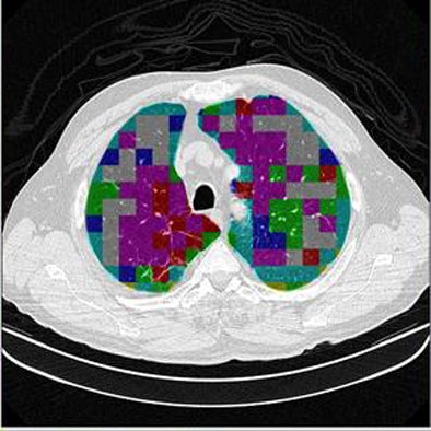 2009 08 19 14 04 35 460 Azevedo finalimages top