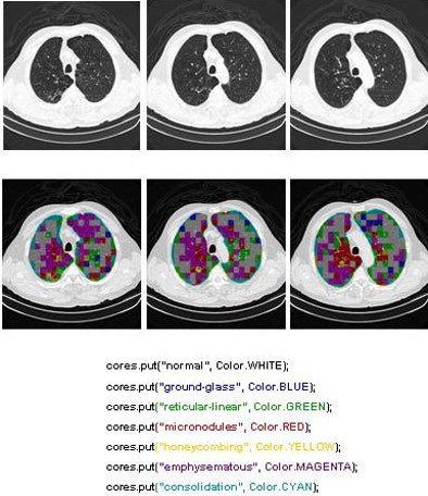 2009 08 19 14 04 38 482 Azevedo finalimages bottom