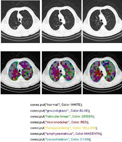 2009 08 19 14 04 38 482 Azevedo finalimages bottom