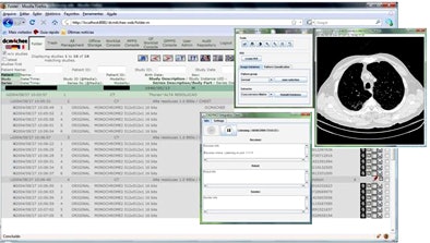2009 08 19 14 04 40 549 Azevedo dcm4chee gui