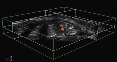 2009 08 31 09 03 37 889 Chang meanstick superbottom