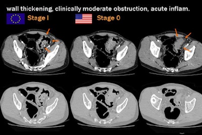 2009 09 22 13 10 19 382 Rogalla wall thickening jpg