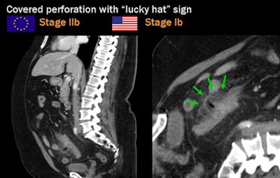 2009 09 22 13 10 23 404 Rogalla luckyhat jpg