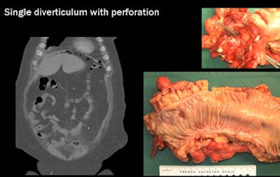 2009 09 22 13 10 31 880 Rogalla airbubble jpg
