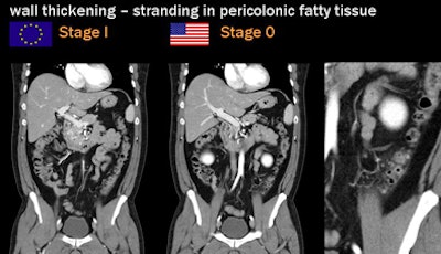 2009 09 22 13 10 32 211 Rogalla wallthicken stranding