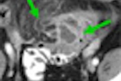 2009 09 22 13 18 45 142 Rogalla thumb 09 09