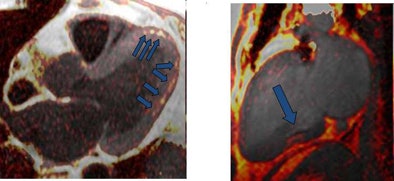 2009 09 24 14 09 18 464 Goldfarb bottom