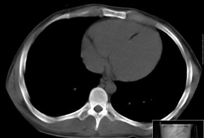 2009 09 24 14 09 19 639 Anderson