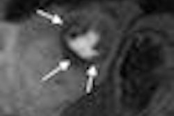 2009 09 24 15 07 33 523 Cmr Image 01 Thumb