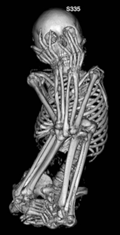 2009 10 02 11 39 49 60 Mummy 200