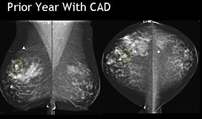 2009 10 16 15 49 29 78 Destounis prioryear cad top jpg