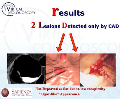 2009 12 15 13 51 05 356 Iafrate 2lesionsonlycad 394