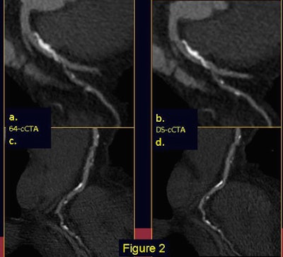 2010 01 07 15 38 29 748 Galea image2