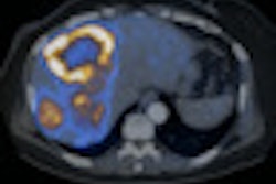 2010 01 08 16 42 44 797 Veit Papillary Carcinoma Thumb