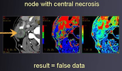 2010 01 22 15 05 35 378 Trojanowska necrotic