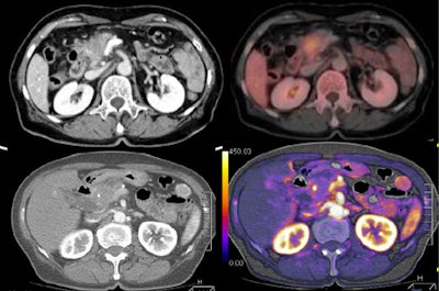 2010 02 02 16 23 40 251 Kandel image1