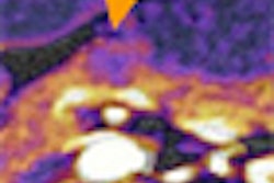 2010 02 02 16 23 43 994 Kandel thumb 02 10