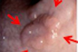 2010 02 03 15 42 47 655 Slabaugh thumb 02 10