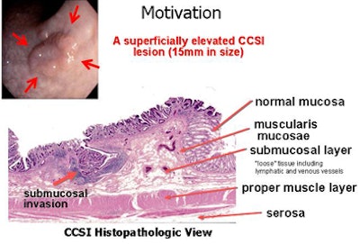 2010 02 03 15 42 58 995 Slabaugh ccsi bottom