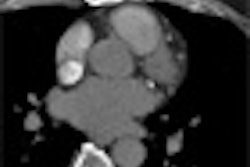 2010 02 19 17 20 32 976 Bovenschulte thumb2 02 10
