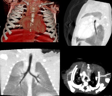 2010 02 24 17 08 29 243 Rogalla vascularring