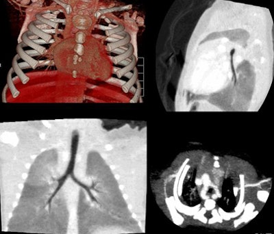2010 02 24 17 08 29 243 Rogalla vascularring