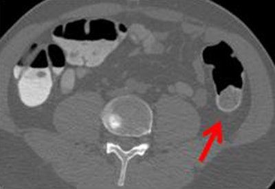 2010 03 07 11 49 52 528 Ferrari poorquality