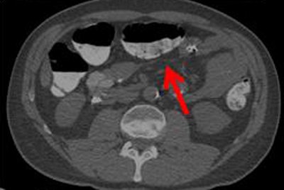 2010 03 07 11 50 05 2 Ferrari averagequality