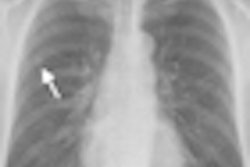 2010 04 26 13 09 41 127 De Hoop Chest Screening Thumb