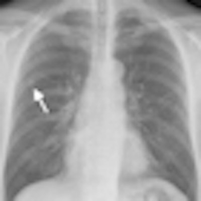 2010 04 26 13 09 41 127 De Hoop Chest Screening Thumb