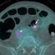 2010 05 26 11 12 12 676 Taylor pet ct Thumb 70